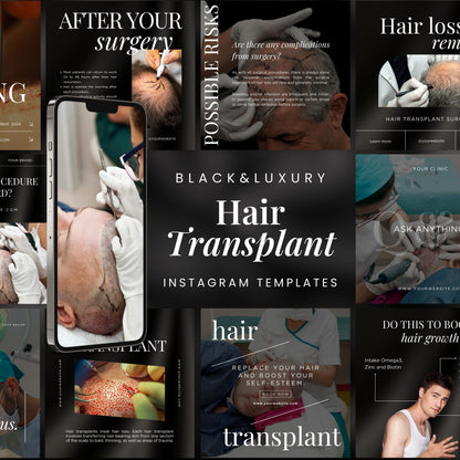 Hair Transplant Instagram Templates