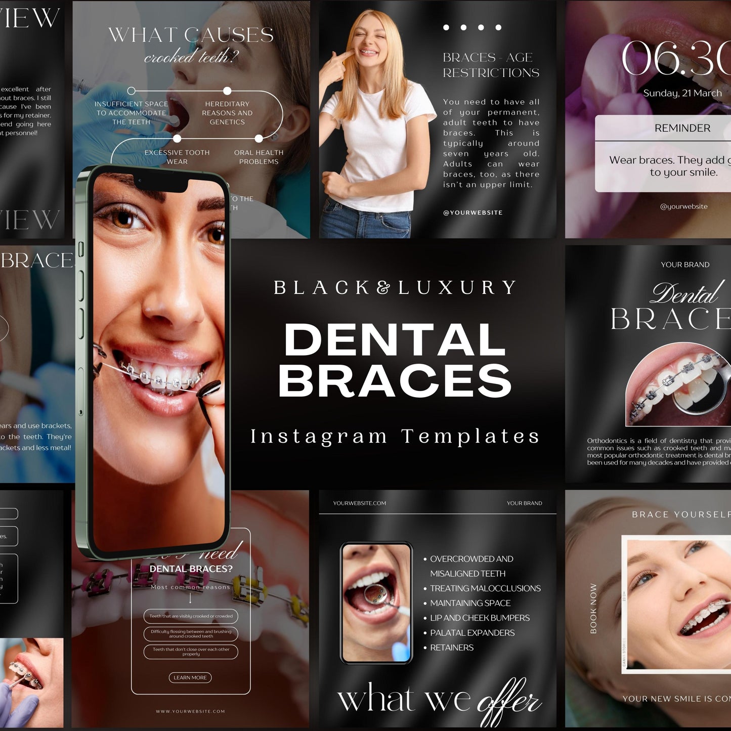 80 Dental Braces Instagram Templates