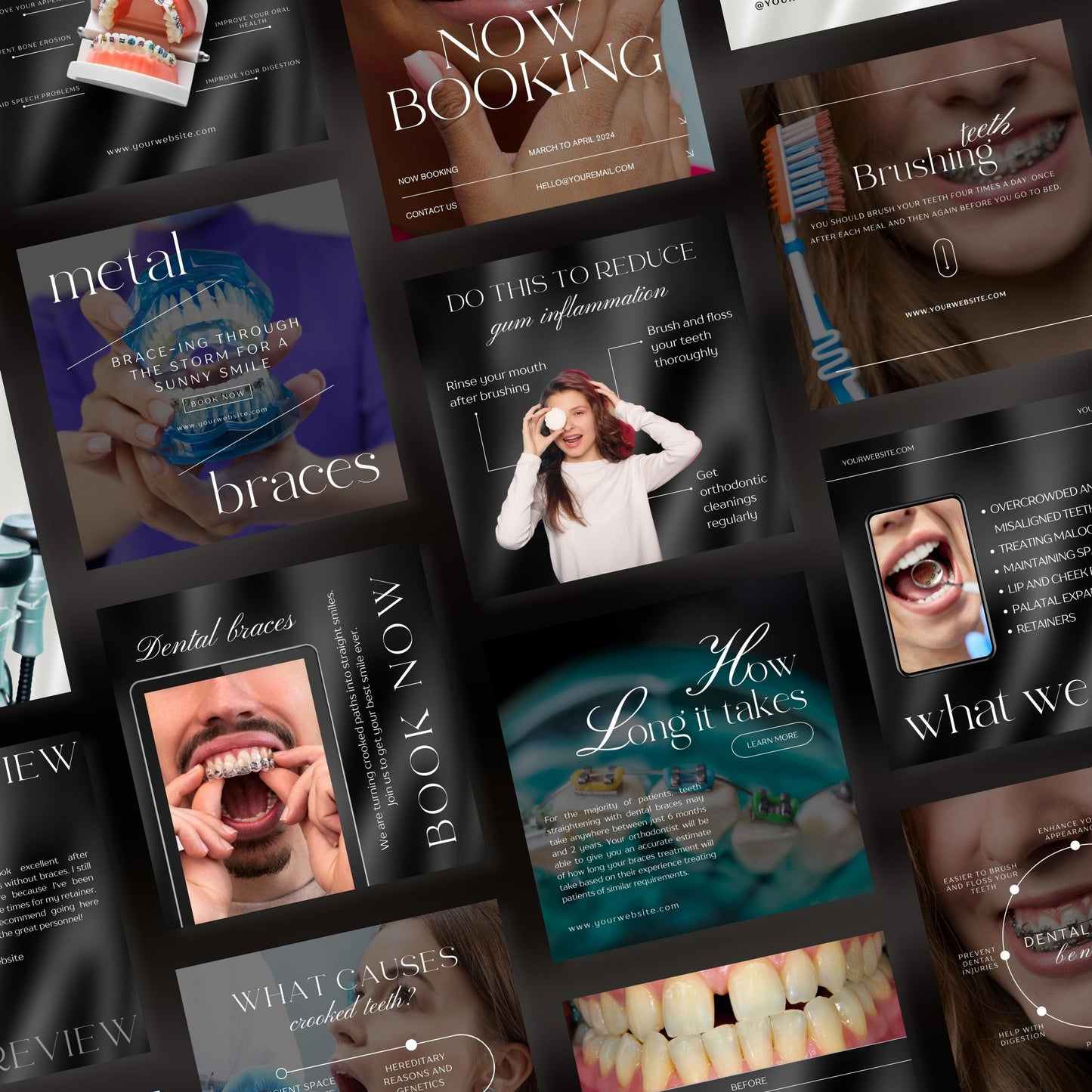 80 Dental Braces Instagram Templates