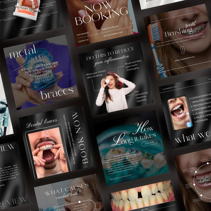 80 Dental Braces Instagram Templates