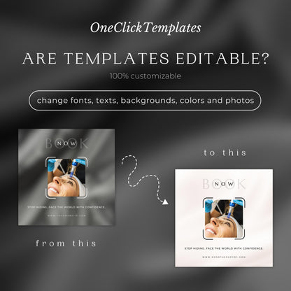 60 Mesotherapy Instagram Templates